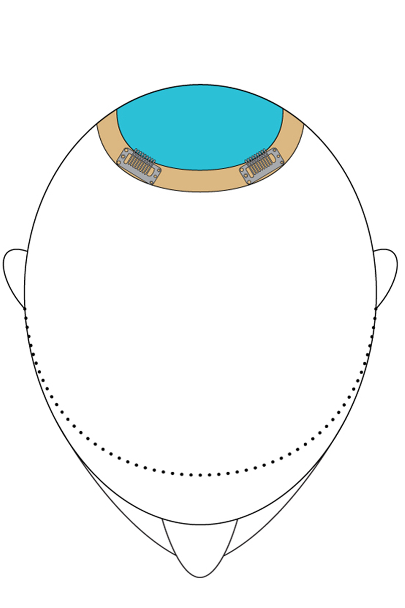 TopThis-placement_color
