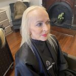 Best Hair Loss Solutions For Frontal Fibrosing Alopecia (FFA)